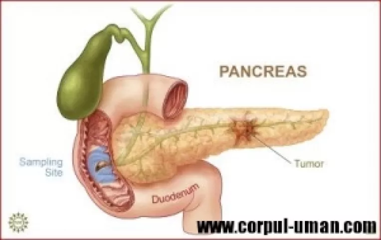 Cancerul de pancreas, una dintre cele mai perfide afectiuni maligne